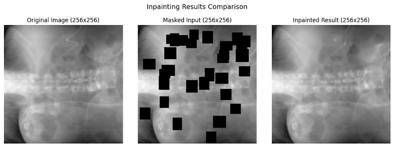 X-ray with masked implant region