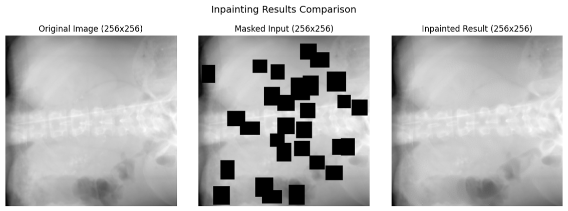 X-ray with masked implant region